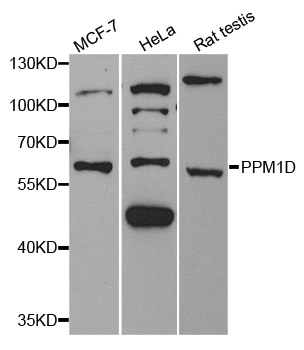 Anti-PPM1D Antibody