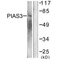Anti-PIAS3 Antibody