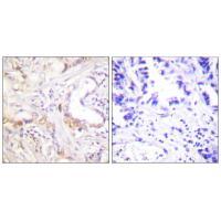 Anti-PIAS3 Antibody Anti-PIAS3 Antibody