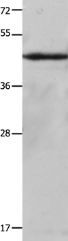 Anti-KRT23 Antibody