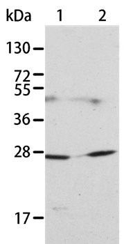 Anti-KLK15 Antibody