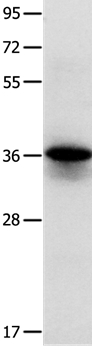 Anti-MYOZ1 Antibody