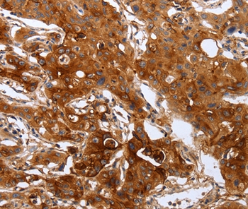 Anti-PLAUR Antibody Anti-PLAUR Antibody