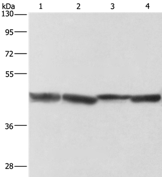 Anti-ADH1A Antibody