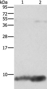 Anti-FXYD1 Antibody