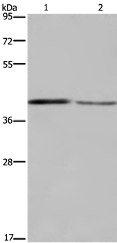 Anti-DEGS1 Antibody