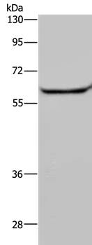 Anti-HACL1 Antibody