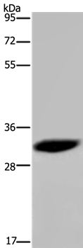 Anti-HMGN5 Antibody