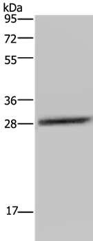 Anti-CEBPD Antibody