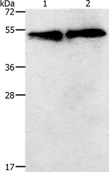 Anti-TACR2 Antibody