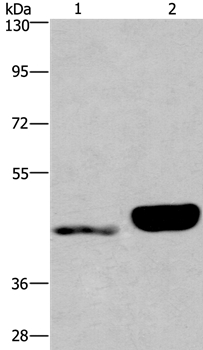 Anti-ENPP4 Antibody