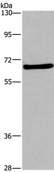 Anti-FEM1B Antibody