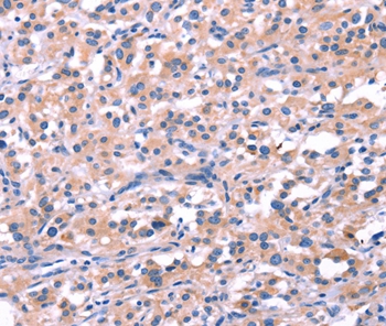 Anti-FEM1B Antibody Anti-FEM1B Antibody