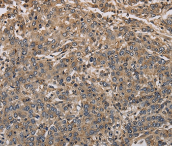 Anti-KCNA7 Antibody Anti-KCNA7 Antibody