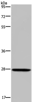 Anti-KLK14 Antibody