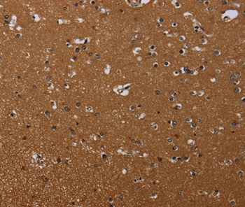 Anti-MOB1A Antibody Anti-MOB1A Antibody