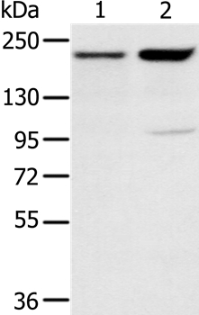 Anti-KDM5A Antibody