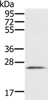 Anti-RBM38 Antibody
