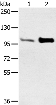 Anti-ACTN2 Antibody
