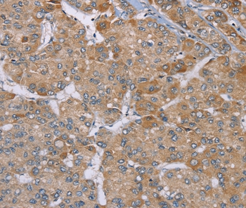 Anti-ACTN2 Antibody Anti-ACTN2 Antibody