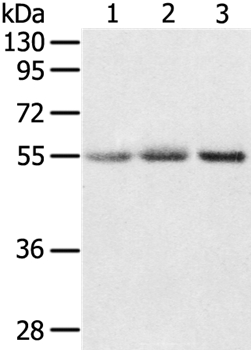 Anti-CWC27 Antibody