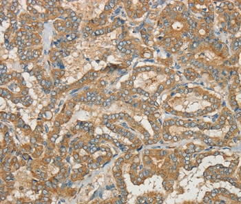 Anti-CWC27 Antibody Anti-CWC27 Antibody