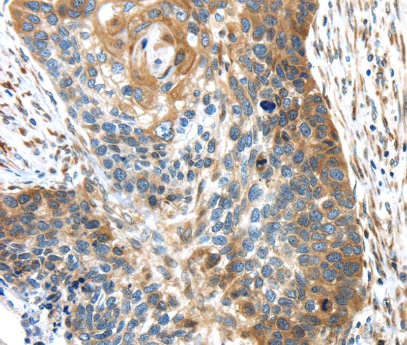Anti-TMED4 Antibody Anti-TMED4 Antibody