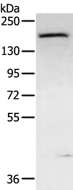 Anti-ABCC9 Antibody