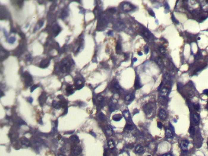 Anti-ABCC9 Antibody Anti-ABCC9 Antibody