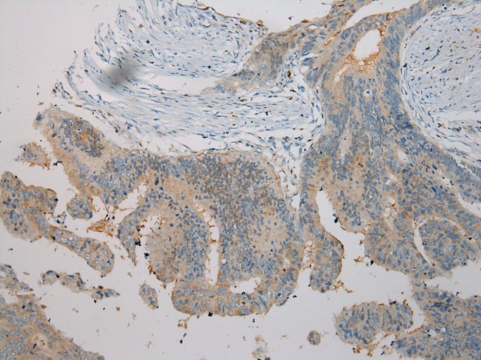 Anti-TNIP1 Antibody Anti-TNIP1 Antibody