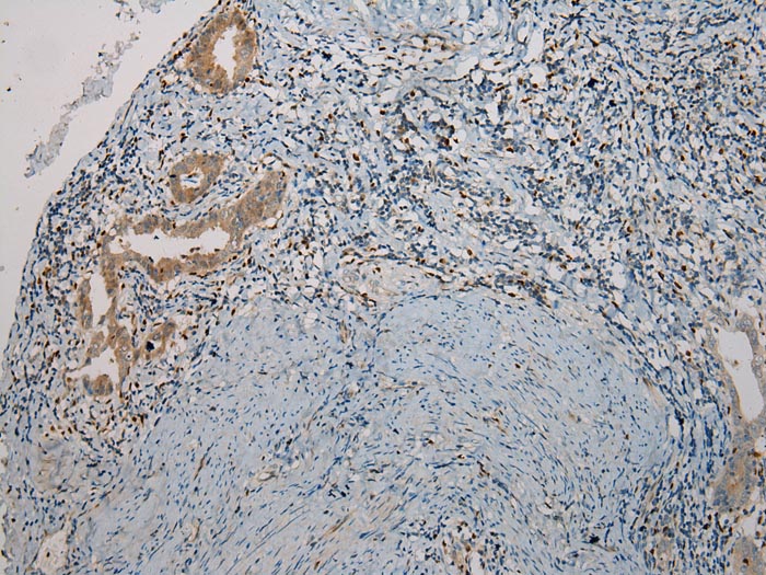 Anti-TNIP1 Antibody Anti-TNIP1 Antibody