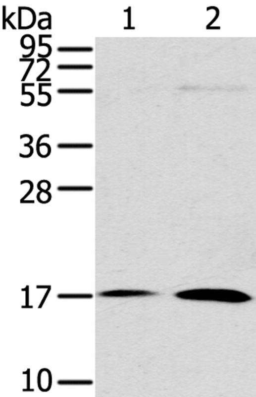 Anti-UTS2B Antibody