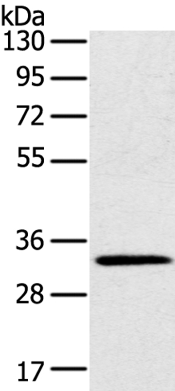 Anti-STK16 Antibody