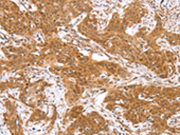 Anti-RGS22 Antibody Anti-RGS22 Antibody