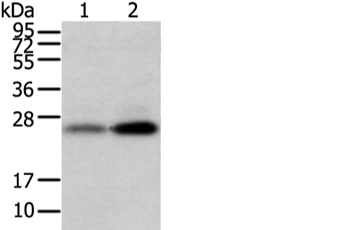 Anti-WFDC5 Antibody