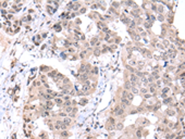 Anti-PCID2 Antibody Anti-PCID2 Antibody
