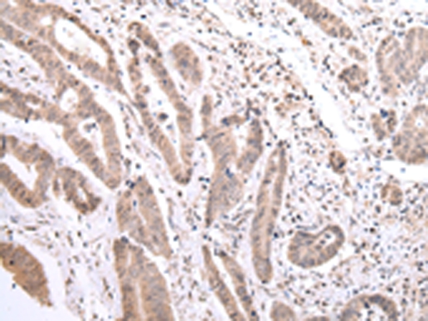Anti-PCID2 Antibody Anti-PCID2 Antibody