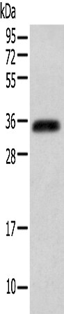 Anti-ITLN2 Antibody