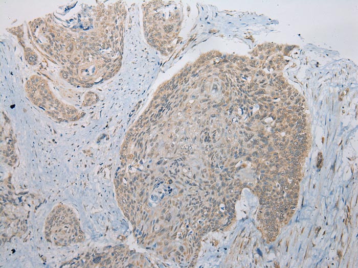 Anti-ITLN2 Antibody Anti-ITLN2 Antibody
