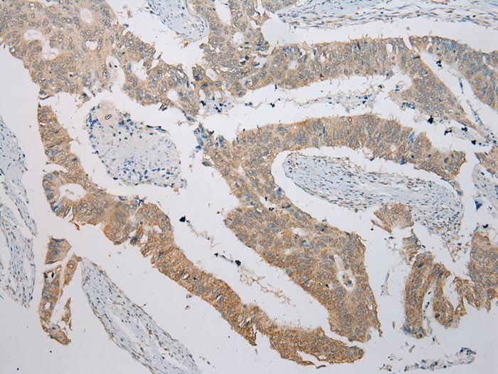 Anti-ITLN2 Antibody Anti-ITLN2 Antibody