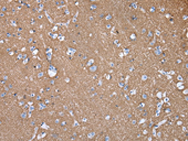 Anti-GNAO1 Antibody Anti-GNAO1 Antibody