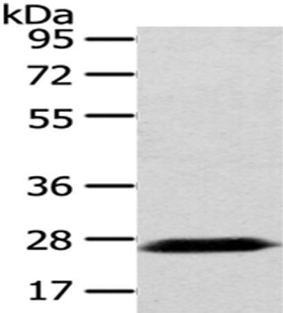 Anti-PDZK1 Antibody