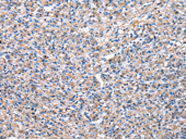 Anti-PDZK1 Antibody Anti-PDZK1 Antibody