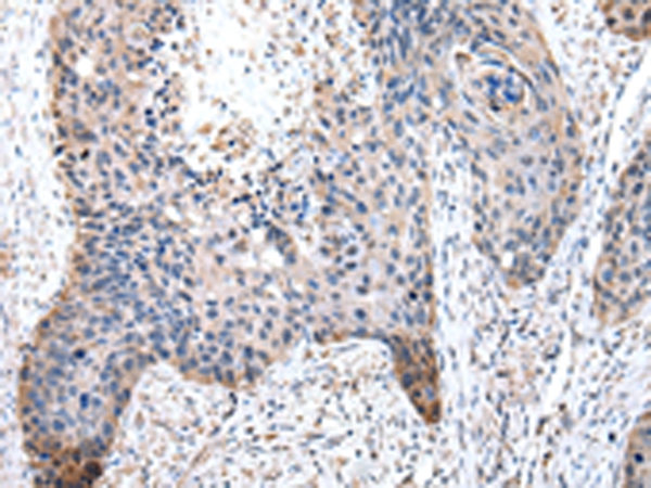 Anti-PDZK1 Antibody Anti-PDZK1 Antibody