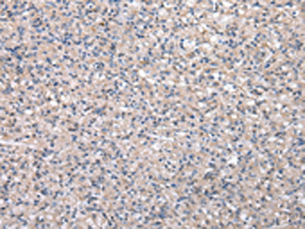 Anti-HPRT1 Antibody Anti-HPRT1 Antibody