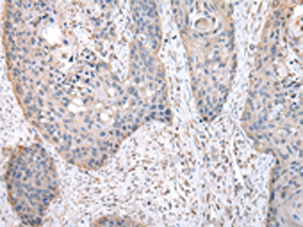 Anti-HPRT1 Antibody Anti-HPRT1 Antibody
