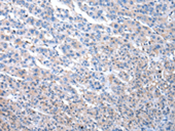 Anti-MASP1 Antibody Anti-MASP1 Antibody