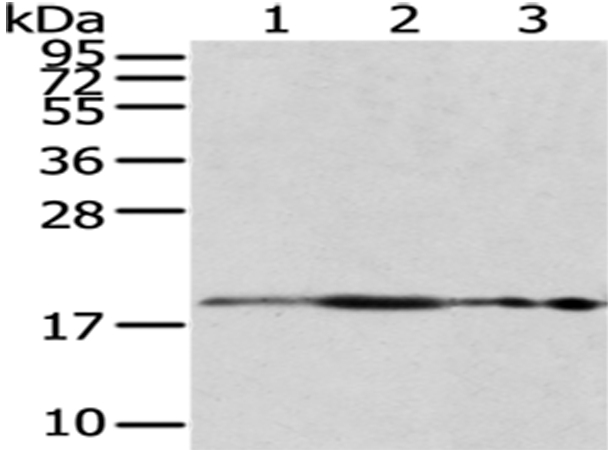 Anti-RPS10 Antibody