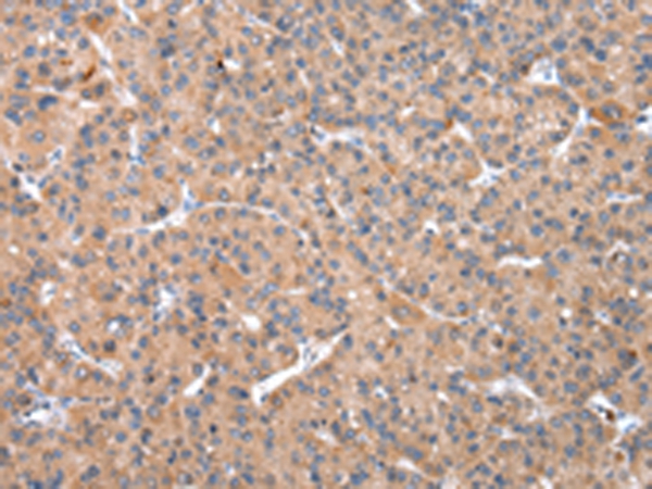 Anti-OXA1L Antibody Anti-OXA1L Antibody