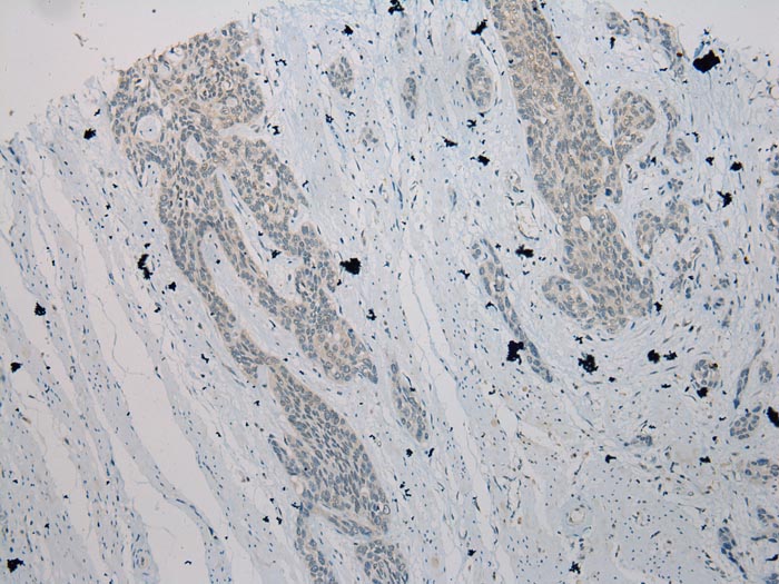 Anti-TXNL1 Antibody Anti-TXNL1 Antibody